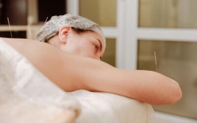 Advanced Acupuncture for Anxiety, Depression, and Insomnia in South Florida | Concierge, Physician-Guided Care